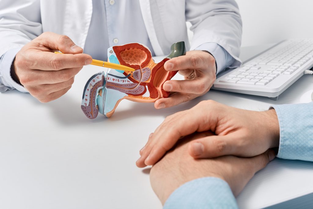 Arzt zeigt Modell von männlichen Geschlecht und zeigt auf die Prostata