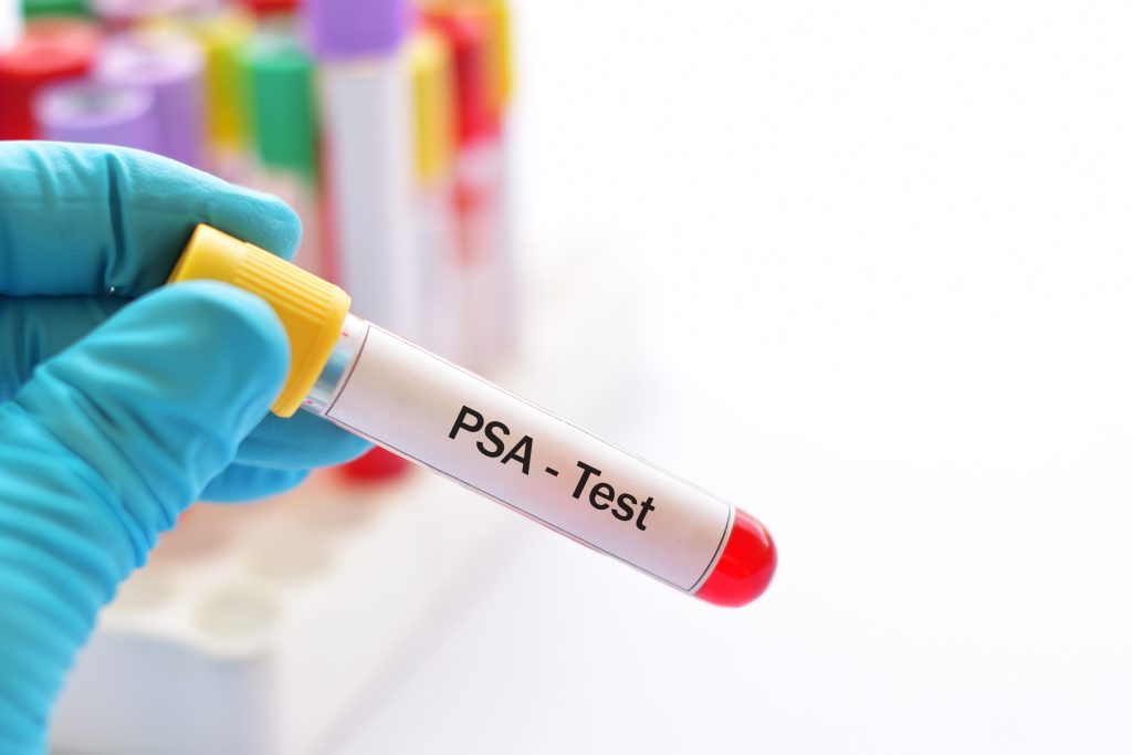 PSA Test